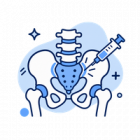 Sacroiliac Joint Injections